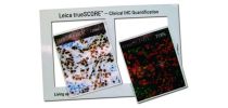 Side By Side Magnetic Photo Frame (95 X 145 X 0.5 Mm)
